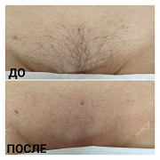 Шугаринг сахарная депиляция Екатеринбург