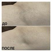 Шугаринг сахарная депиляция Екатеринбург