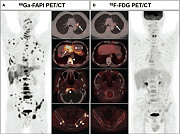ПЭТ-КТ) — современный метод, позволяющий выявлять онкологические Ташкент