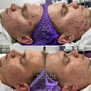 Косметолог-эстетист Сургут Сургут