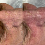 Косметолог-эстетист Сургут Сургут