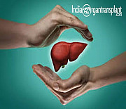 Топ-10 центров по пересадке печени в Индии. Delhi