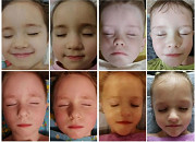 Логопедический массаж с выездом на дом Нижний Новгород