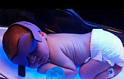 Желтушка новорожденных фотолампа Саратов